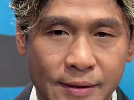 #宋小宝说自己微调过 宋小宝微调过?你看的出来吗?