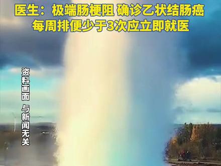 深圳一男子便秘10几天没当回事,送医后粪便从嘴里喷涌而出,医生:极端肠梗阻,确诊乙状结肠癌,每周排便少于3次应立即就医