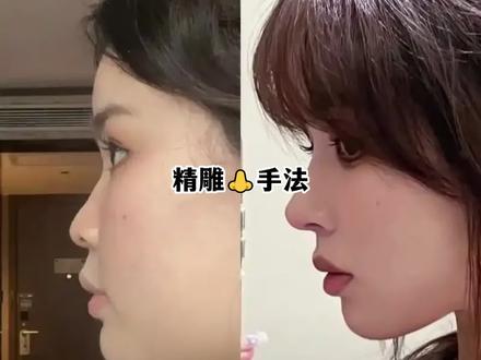 今天老师给你一个手法,你练习下就知道!