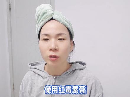 使用红霉素膏祛斑的视频爆了,评论区一一回复,别涂抹错了 #护肤技巧 #分享爱用物