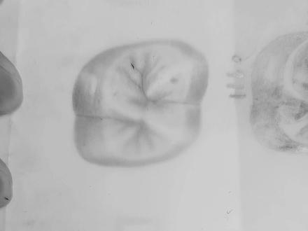 画上颌第一磨牙#牙医日常 #铅笔画