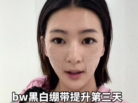 看着是不是开始有变化了#原相机的自己 #面部提升 #馒化脸 #日常记录