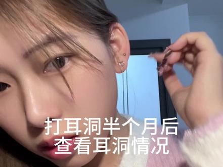 打耳洞半个月啦,来看一下耳洞情况。新做了美甲真的很难处理这么小的耳钉,pps这个耳钉的质量还不错,是医用钛钢的。最后,没什么事就别动它了,不然就跟我一样扎出血了#打耳洞 #耳骨钉 #打耳洞很痛吗 #第一次打耳洞 #耳洞怎么打