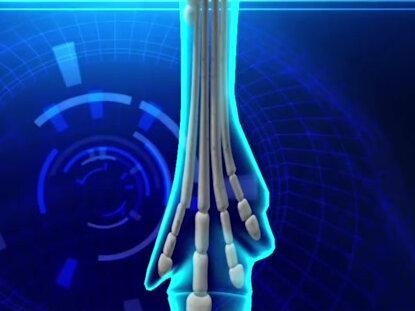 大象三条腿都能活,马的腿断了为何必须死? 它真有这么脆弱吗#赛马#动物保护 #大象 #救治 #科普