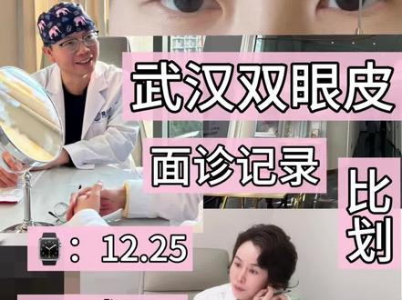 关于我一天面了俩 还逛了江滩哈哈哈,舒适~简单写下😎#武汉双眼皮 #武汉蒜皮 #双眼皮面诊