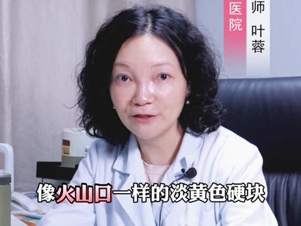 生活中常见的四种疣,都是#HPV 病毒感染导致的,这个视频教你正确区分,记得点赞收藏#丝状疣 #寻常疣 #扁平疣 #跖疣