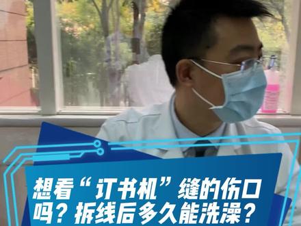 想看“订书机”缝的伤口吗?拆线后多久能洗澡?#骨科 #健康科普 #伤口