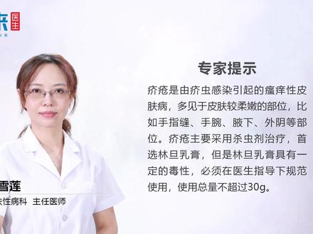 疥疮用什么药膏最好?多选用这些药物,谨遵医嘱才是关键!