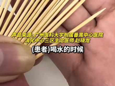 近日,#广东 一男子叼牙签喝水时误吞#牙签 ,腹痛两天就诊时发现,牙签已穿破十二指肠肠壁并刺入右肾。医生提醒:如果不慎误吞异物,尤其是尖锐物,请立即禁食禁水,马上前往医院就诊!#健康 (编辑:小粥)