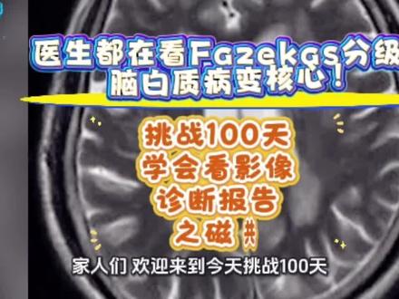 #医学科普 虽迟但到,雨声哪有学知识更助眠。请伴着我的科普视频入眠。为什么医生都看Fazekas分级?脑白质病变核心!