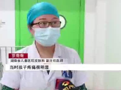 过量喷洒杀虫剂,女孩全身长水泡! #儿童安全 @抖音小助手