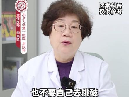 长针眼又肿又疼,医生教你个小方法#针眼 #麦粒肿 #科普 #健康科普 #抖出健康知识宝藏