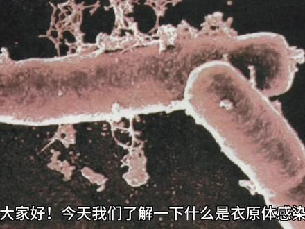 什么是衣原体感染#衣原体#生殖道感染