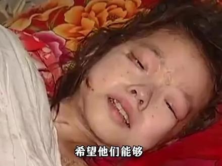 十岁女孩全身溃烂生蛆,与爷爷相依为命,临死之际想见父母!#纪录片 #玉玲 #感人 #人间冷暖 #社会百态