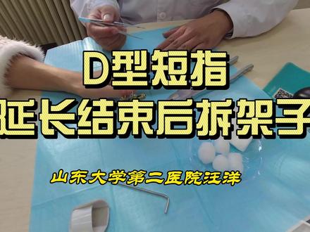 #d型短指症 延长结束后拆架子#医学科普