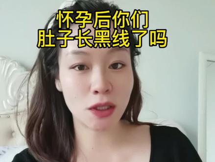 怀孕后肚子上的黑线好明显,孕妈们你们也长了吗#虎宝宝 #孕期记录