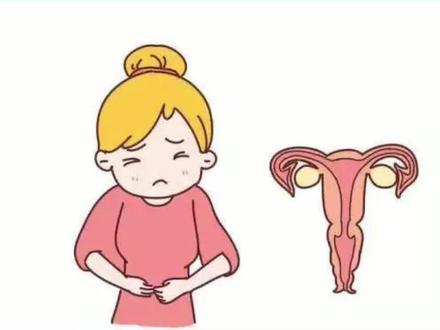 什么是宫颈糜烂#医学科普 #关爱女性健康