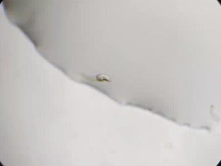 日本血吸虫感染阶段尾蚴