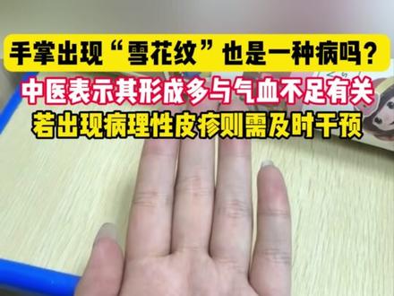 手掌出现“雪花纹”也是一种病吗?中医表示其形成多与气血不足有关,若出现病理性皮疹则需及时干预。#气血不足 #养生 #气血