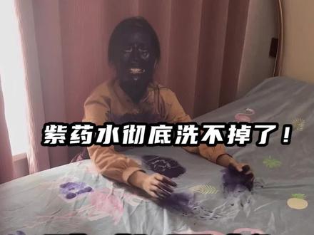 四天了!!紫药水还没洗掉!!@妍妍小姐姐