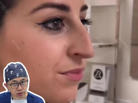 你是什么鼻? #鼻子#自测#鼻综合#好看的鼻子#科普