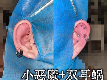 丝滑完成一堆钉子,小花燃尽了#小恶魔 #双耳蜗 #穿孔 #迁西穿孔