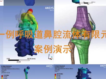 一例呼吸道鼻腔流体有限元案例演示. #模流分析 #fluent医学流体分析