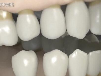 掉牙和寿命有关?60岁的人牙齿剩几颗才正常?建议了解一下 #老人 #牙齿 #健康