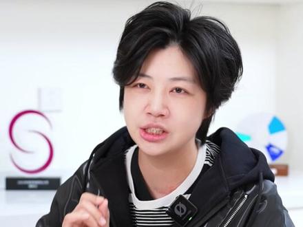 全网爆火的眼眶外C注射,你真的打对了吗?打对脸小又年轻 #眶外侧凹陷 #眼眶外c #上海医美 #黄晔文 #眼周年轻化