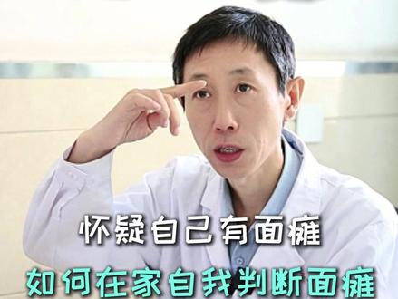 如何在家自我判断面瘫 #医学科普 #齐鲁医院