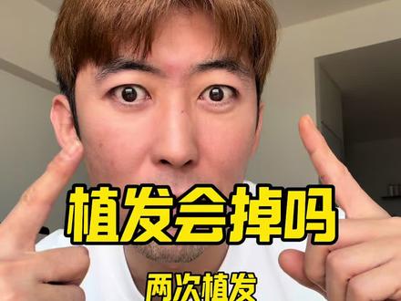 植发会掉吗 两次植发 植发体验分享 个人感受仅供参考 #植发 #植发前后对比 #植发术后恢复 #植发会掉吗 #植发体验分享