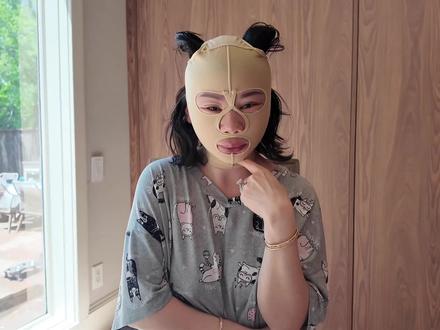 好久不见,42 岁的我做了个大拉拉 🫢
#大拉皮术后