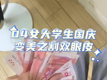 国庆变美第一步:割蒜皮啊哈哈哈。从小就想割的双眼皮终于割了 再也不是单眼皮喽~ #蜕变过程 #双眼皮 #双眼皮蜕变记 #让我们一起变美