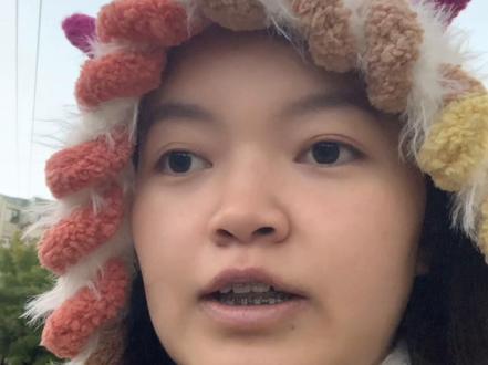 救命!正颌后掉发这么多?破大防了😭
#正颌#术后恢复 #掉发 #调理身体 #真实生活分享官