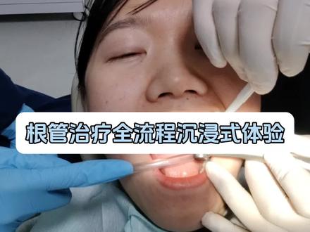 根管治疗日记#口腔健康 #根管治疗