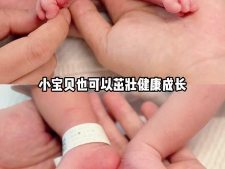 恭喜谈莉娜解锁人生新篇章 #谈莉娜分享剖腹产生子过程 #谈莉娜