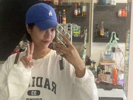 30岁带钢牙的优缺点,最后一点很重要!#正畸 #牙齿矫正