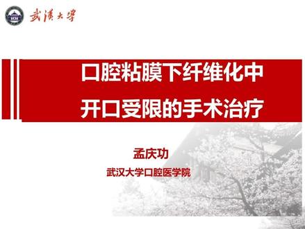 吃槟榔粘膜下纤维化的张口受限的手术治疗3 #粘膜下纤维化 #张口受限 #颞下颌关节 #槟榔