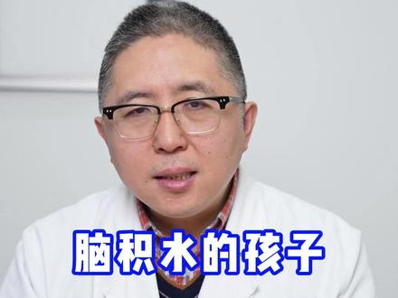 脑积水能治吗? #脑积水 #硬核健康科普行动 #脑脊液