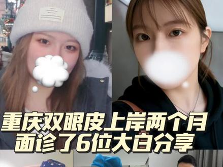 自己整理的面诊的心得,没有讲什么专业知识,都是自己写的,发出来供大家参考#重庆双眼皮#分享
