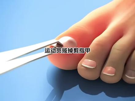 运动员忍痛拔掉剪指甲的原因#冷知识#科普#剪指甲
