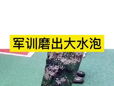 脚上手上长水泡了,如何正确处理?#健康 #希望能帮到你 #皮肤