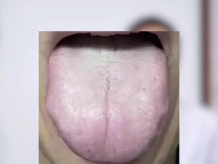 阳虚太久生了寒湿,再用附子理中丸补阳就是大错 #硬核健康科普行动 #中医 #医学科普 #干货分享