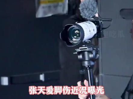 张天爱脚受伤了,连拄拐都这么美 #张天爱