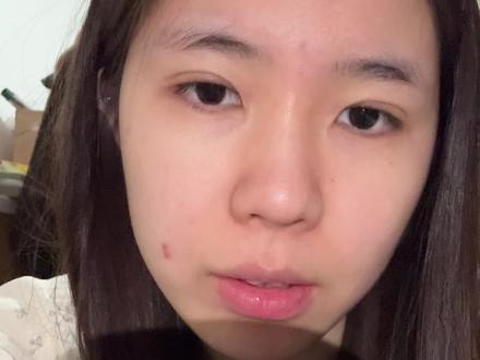 爸爸说上个班开始飘了呗
两个月工资去办了这个事😭你们父母是什么反应#双眼皮恢复记录 #眼综合恢复期 #双眼皮蜕变记 #肿眼泡