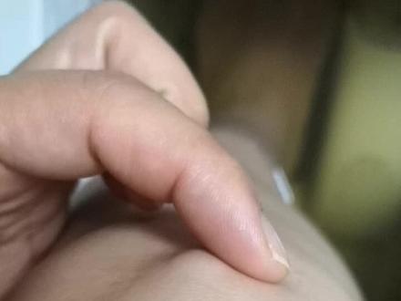 膝盖处有一颗豌豆大小的颗粒,到处跑,不碰也没感觉,但跪着就很疼,有人有相似的情况吗#即刻成为2060元住民