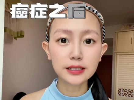 钱的事不想提,但治病确实需要。
医保、门特、二次报销、大病救助、低保、商保、惠民保……能申请的别嫌麻烦,去问就对了。
各地政策不一样,以当地为准。#癌症报销 #抗癌日记#积极心态#门特#年轻人换癌