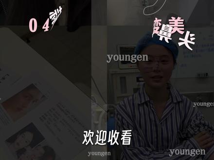 蒜头鼻女孩在上海逆袭天菜的do鼻vlog~~ 出镜人已签署相关肖像授权 此视频不宣导任何风险医疗项目!#上海潘峰#肋骨鼻#妈生鼻#鼻修复#鼻修复潘峰