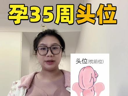 头位宝宝在妈妈肚子里的状态❗️
#孕晚期 #头位宝宝 #头位宝宝在肚子里的姿势 #头位顺产 #真实生活分享官 @抖音创作灵感