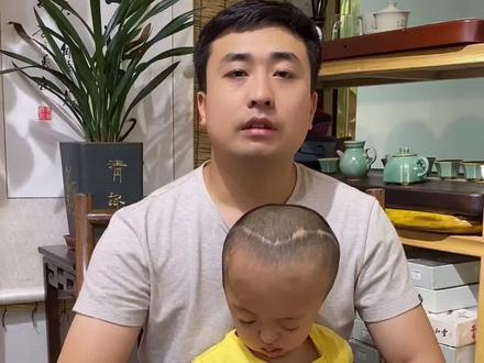 这种病真的很罕见!很多人都没有听过!希望能帮助到更多的人!#基因突变#克鲁宗综合征